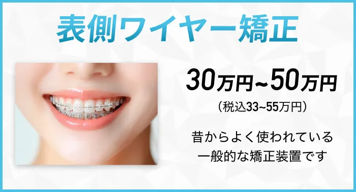 表側ワイヤー矯正 昔からよく使われている一般的な矯正装置です