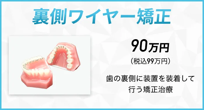 裏側ワイヤー矯正 歯の裏側に装置を装着して行う矯正治療