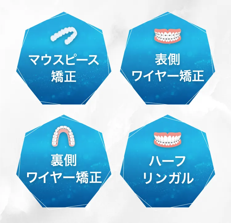 マウスピース、表側ワイヤー、裏側ワイヤー、ハーフリンガル矯正の種類
