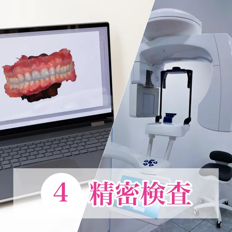 4、精密検査
